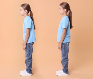 Good and bad posture, collage. Girl standing on dark beige background, side view