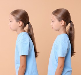 Good and bad posture, collage. Girl standing on dark beige background, side view