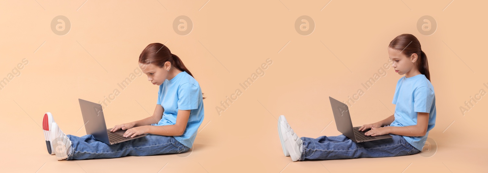 Image of Good and bad posture, collage. Girl sitting with laptop on dark beige background