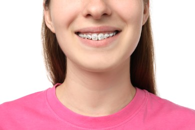 Photo of Girl with braces on white background, closeup