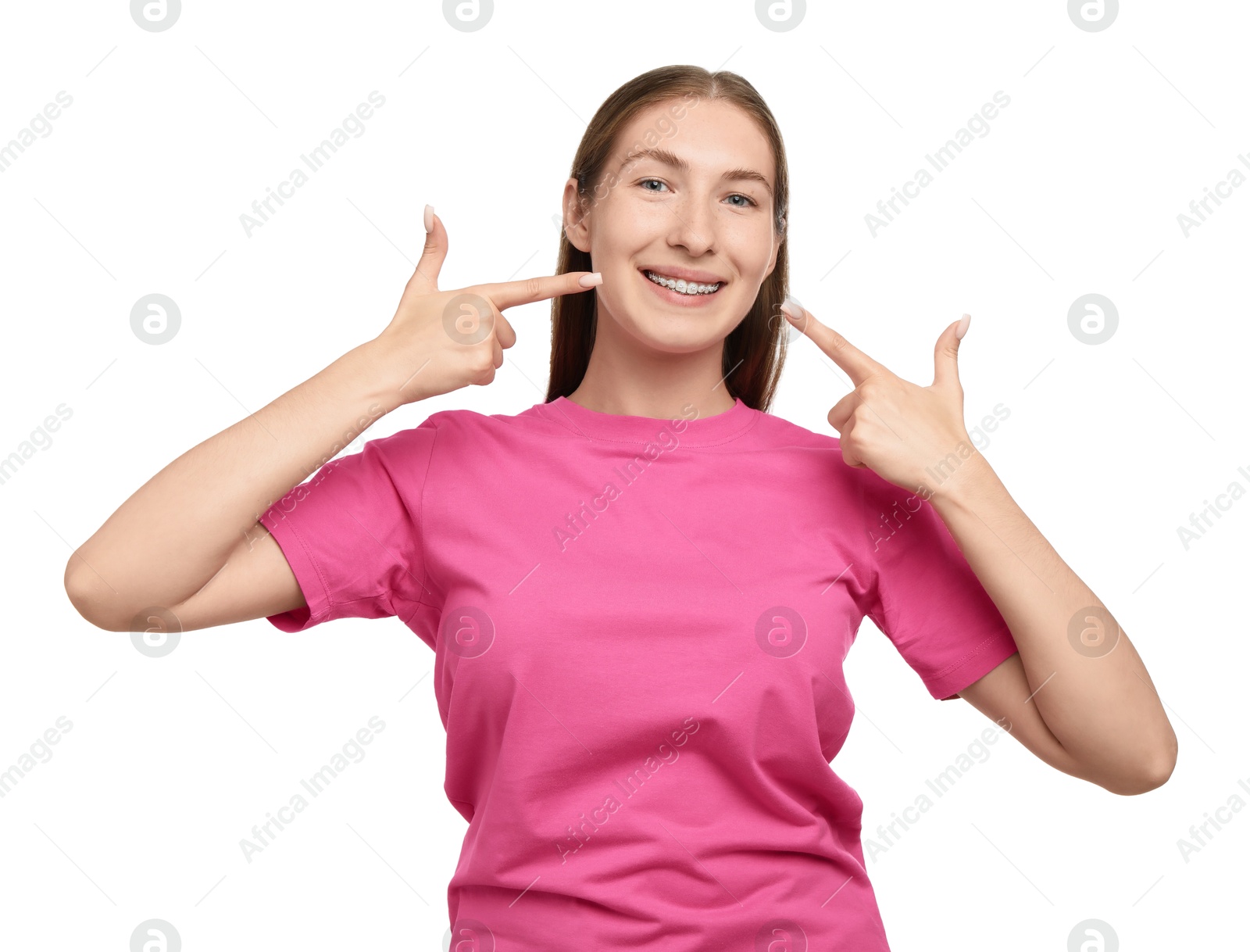 Photo of Smiling girl pointing at her braces on white background