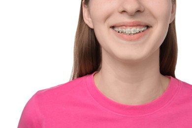 Photo of Girl with braces on white background, closeup