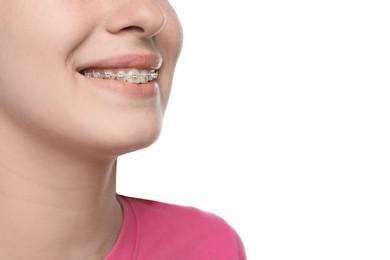 Photo of Girl with braces on white background, closeup