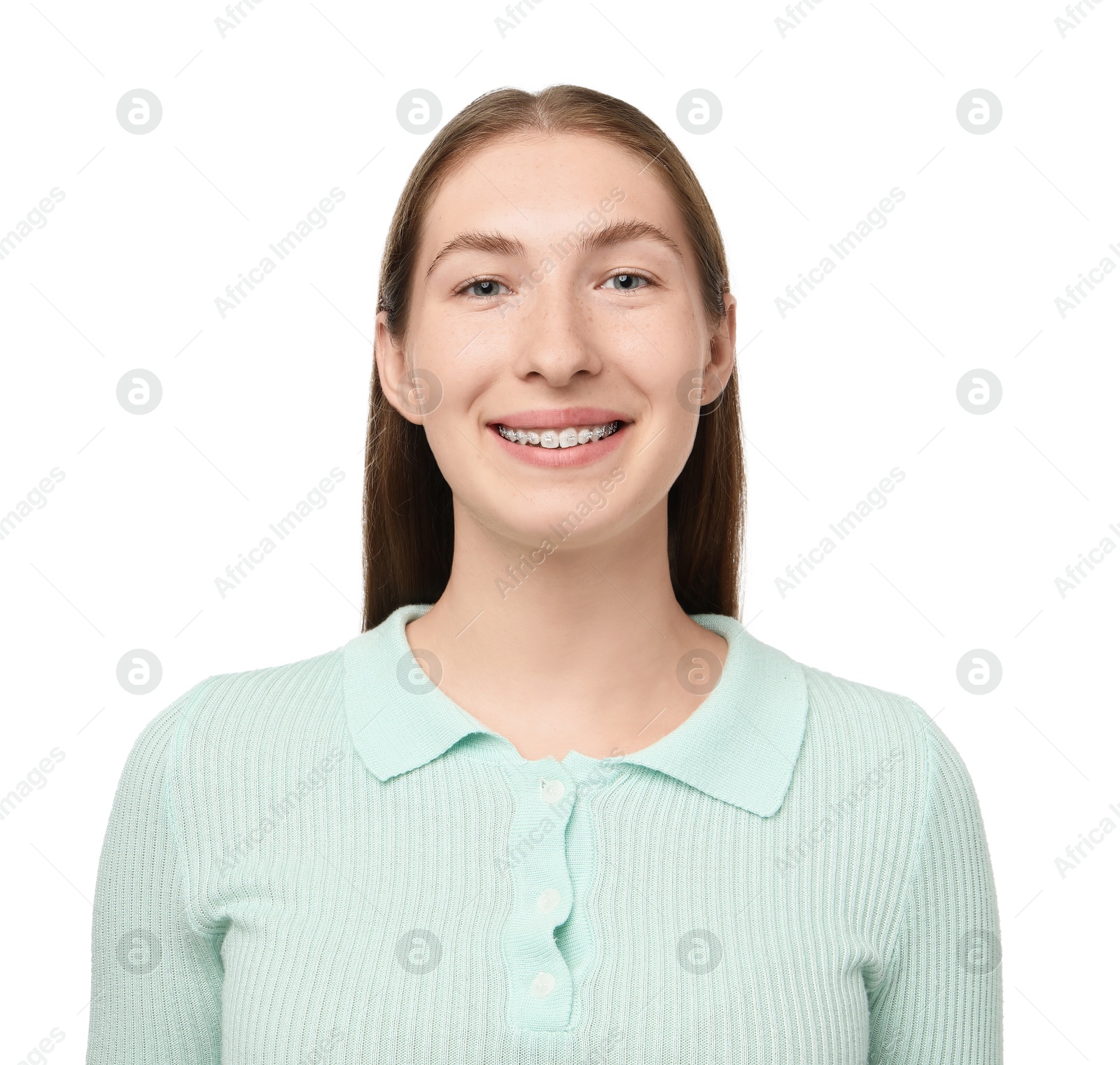 Photo of Smiling girl with braces on white background