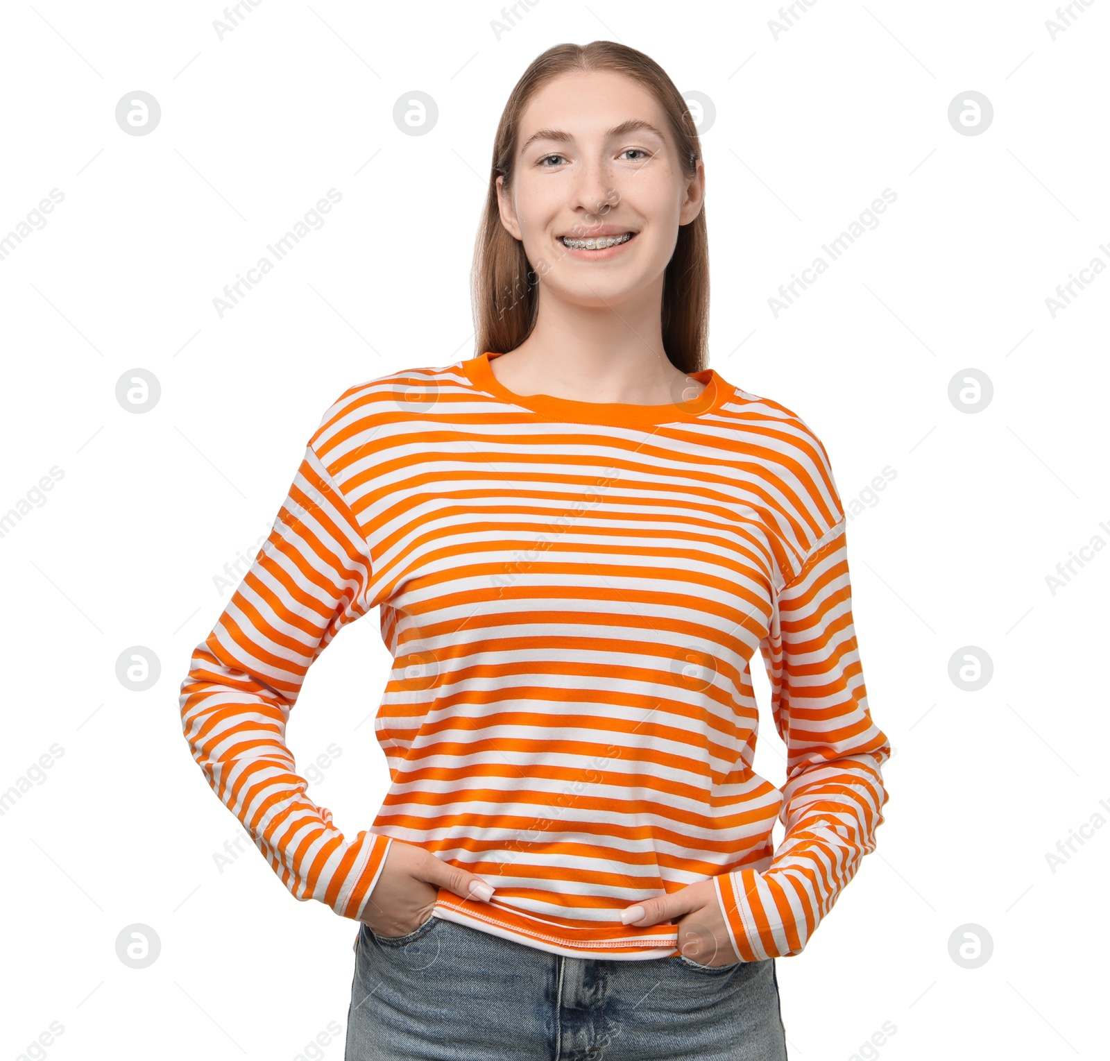 Photo of Smiling girl with braces on white background