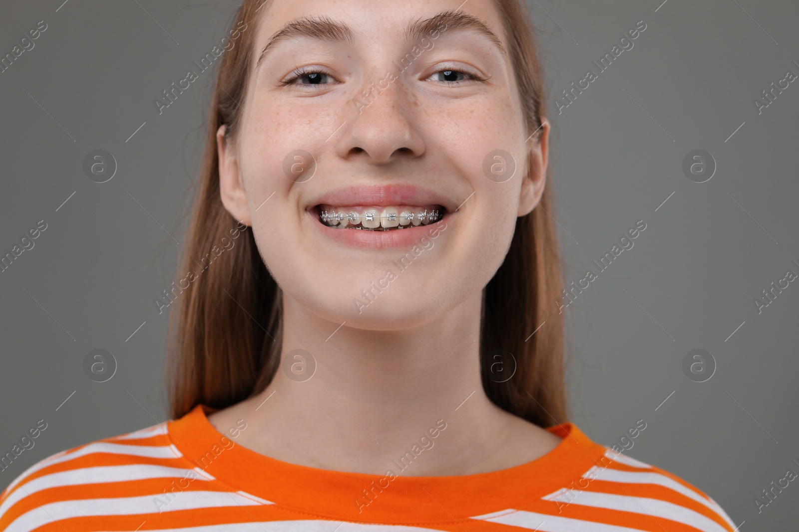 Photo of Smiling girl with braces on grey background