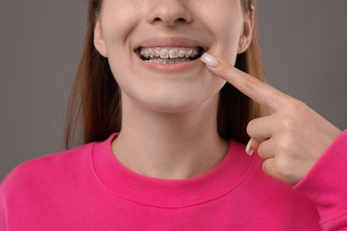 Photo of Girl pointing at her braces on grey background, closeup