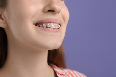 Photo of Girl with braces on purple background, space for text