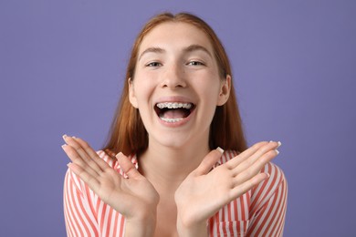 Photo of Smiling girl with braces on purple background