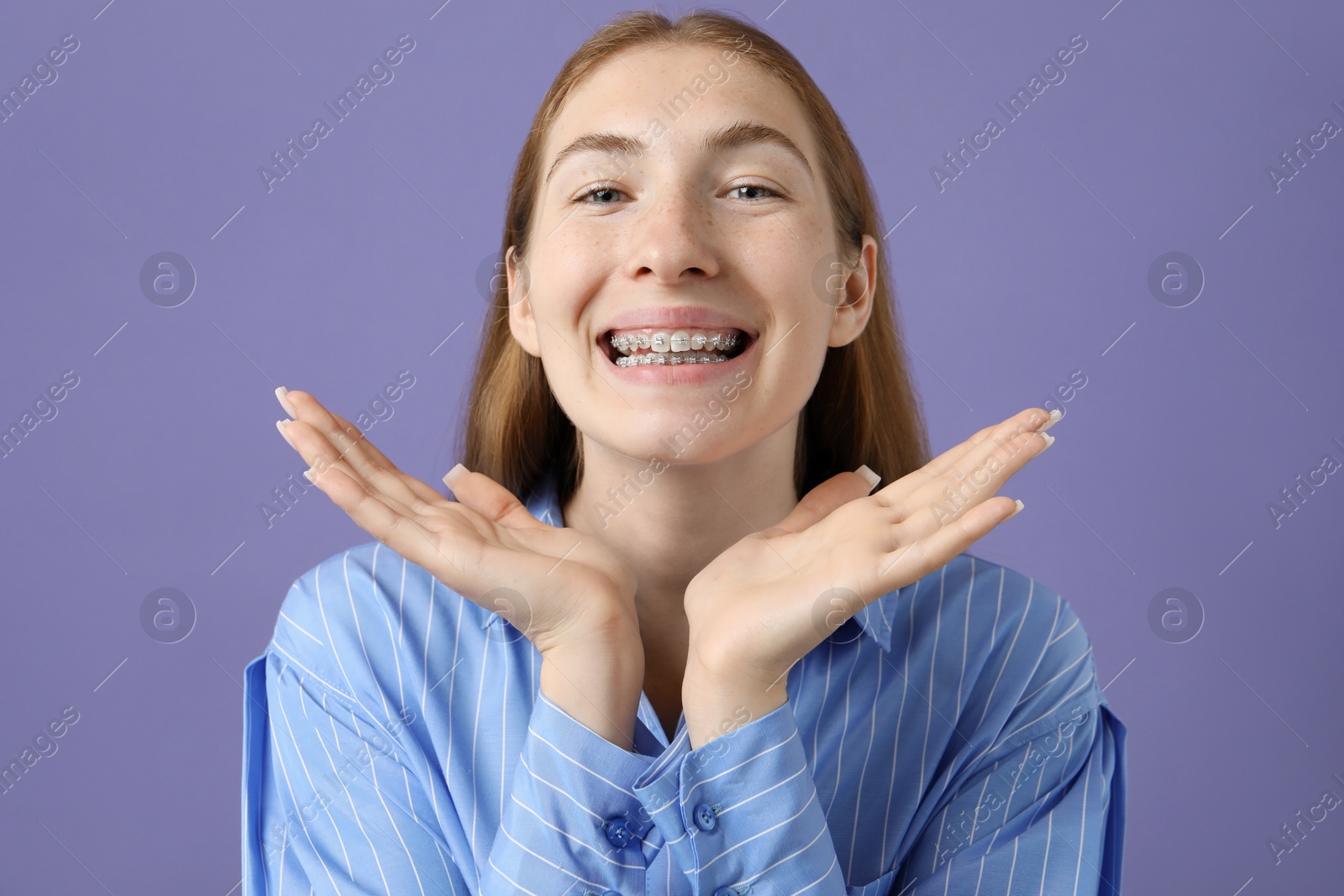 Photo of Smiling girl with braces on purple background