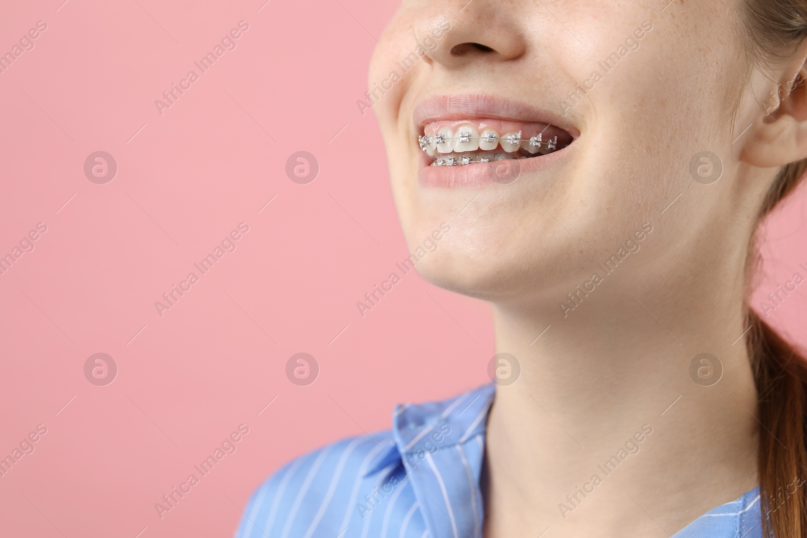 Photo of Girl with braces on pink background, closeup. Space for text