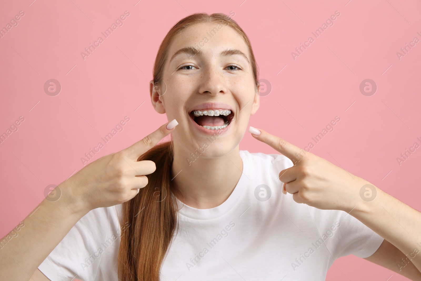 Photo of Girl pointing at her braces on pink background