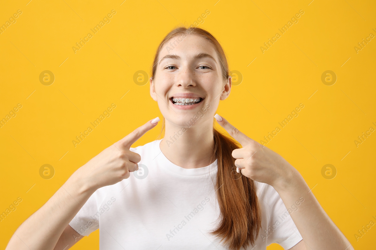 Photo of Girl pointing at her braces on orange background