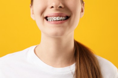 Photo of Girl with braces on orange background, closeup