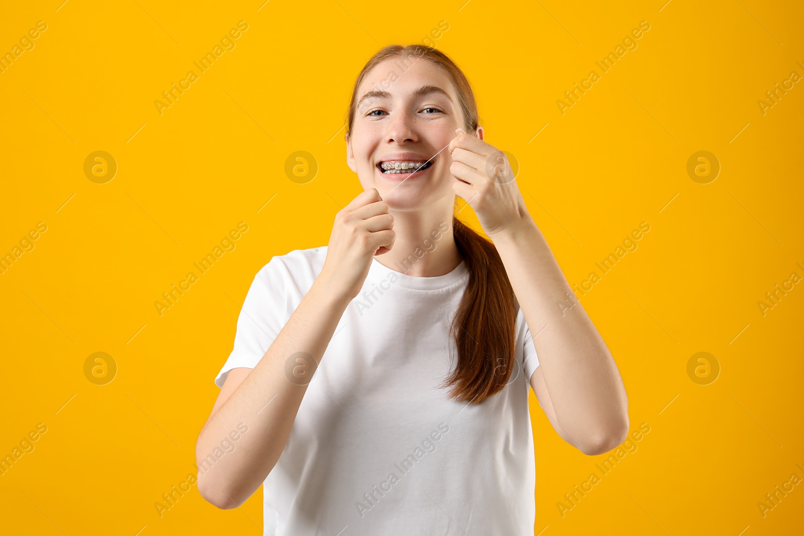 Photo of Girl with braces cleaning teeth with dental floss on orange background