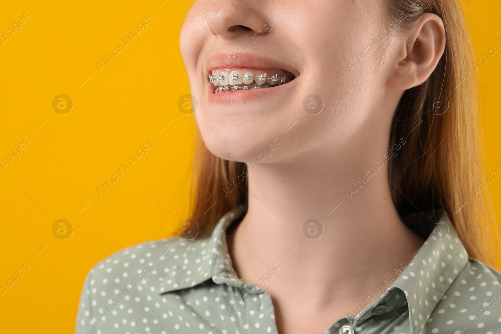 Photo of Girl with braces on orange background, closeup