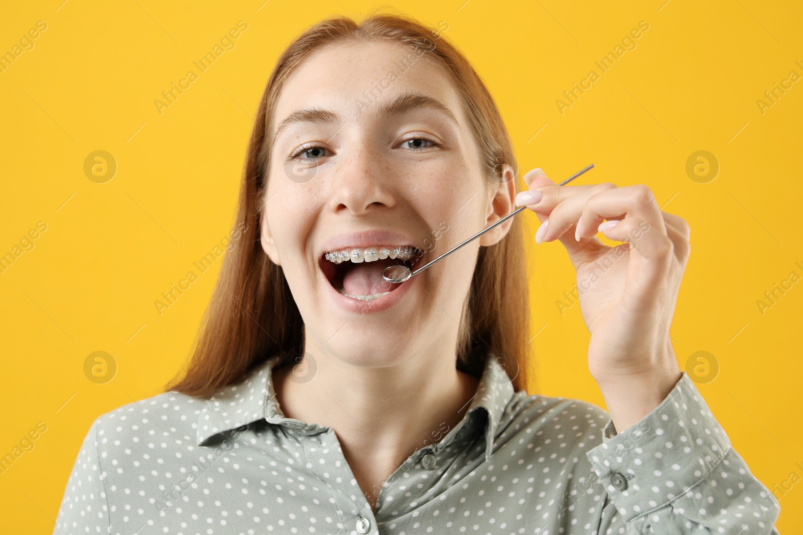 Photo of Girl with braces using dental mirror on orange background