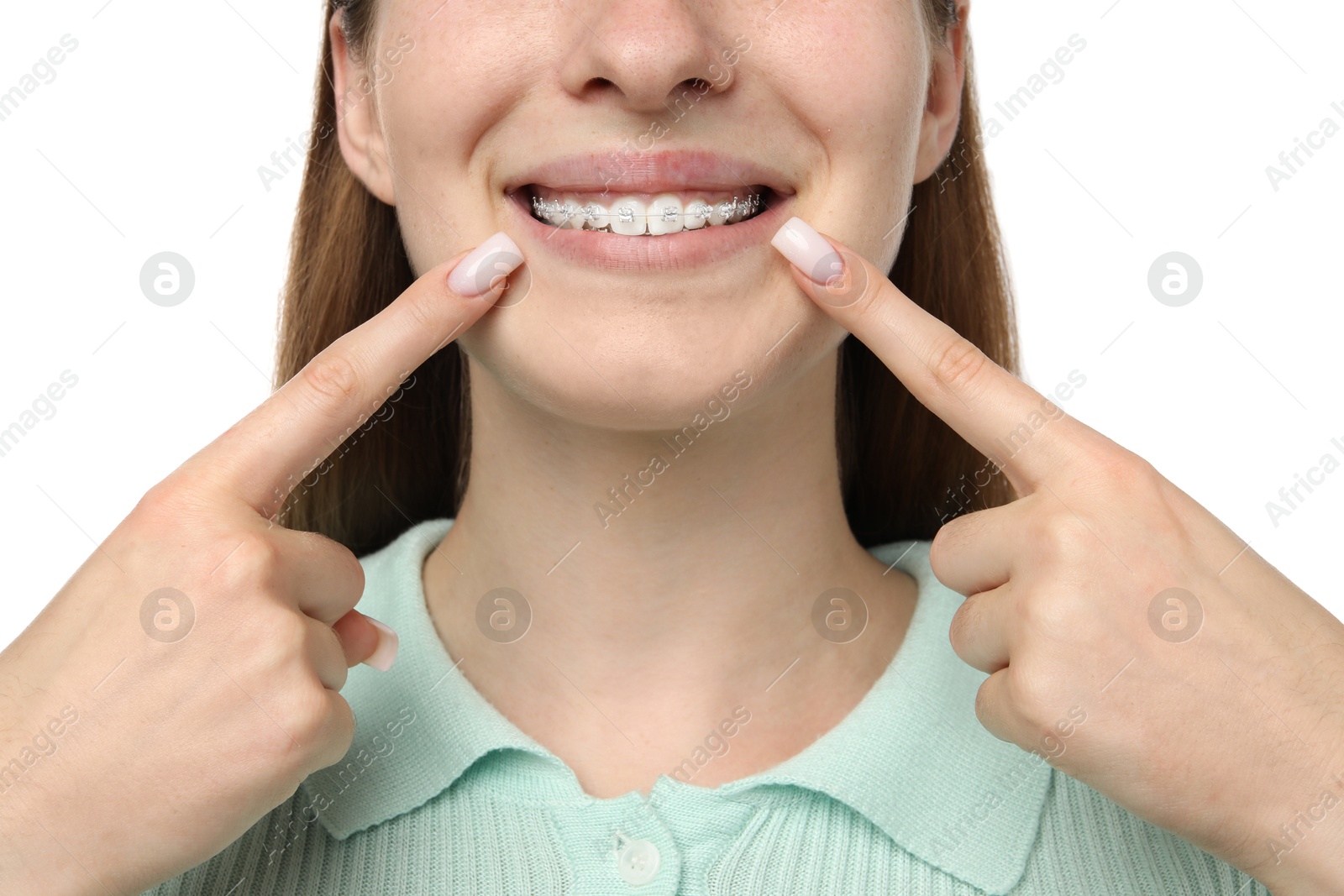 Photo of Girl pointing at her braces on white background, closeup