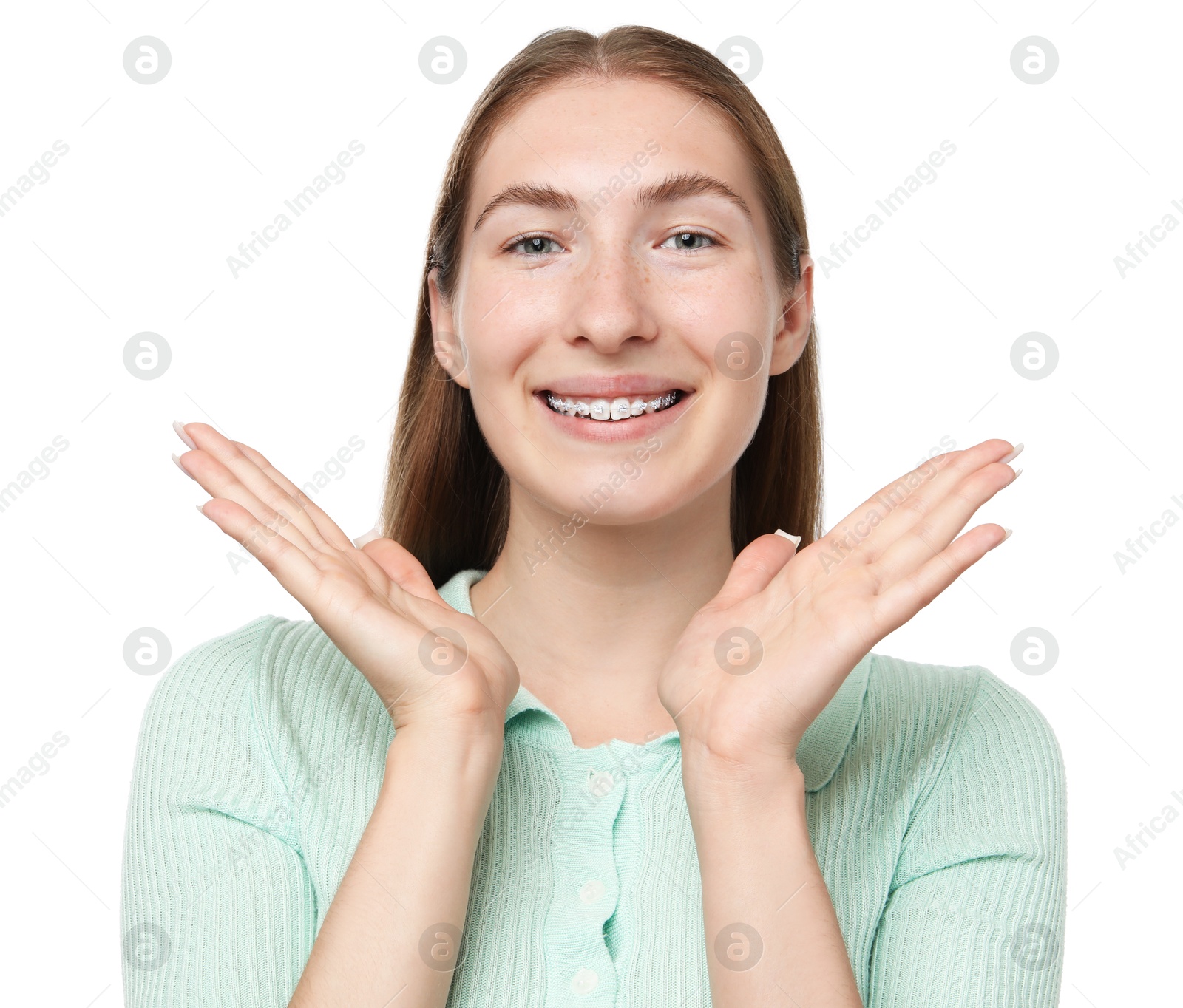 Photo of Smiling girl with braces on white background