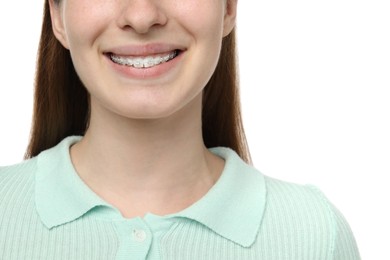 Photo of Girl with braces on white background, closeup