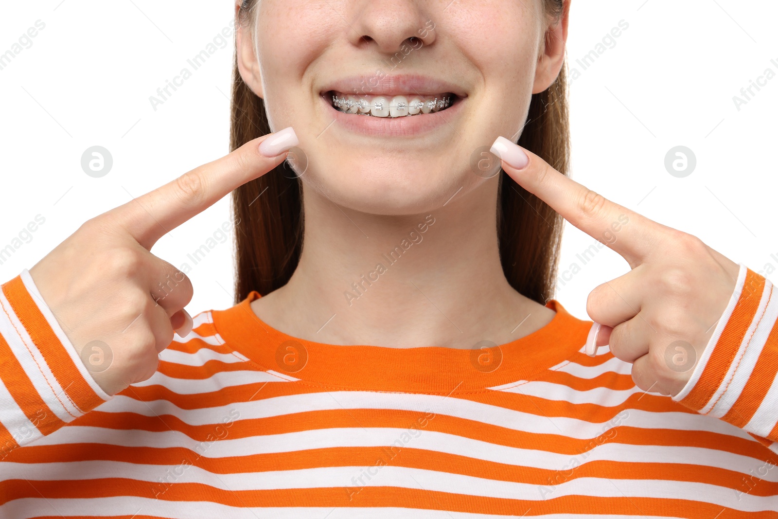 Photo of Girl pointing at her braces on white background, closeup