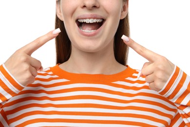 Photo of Girl pointing at her braces on white background, closeup