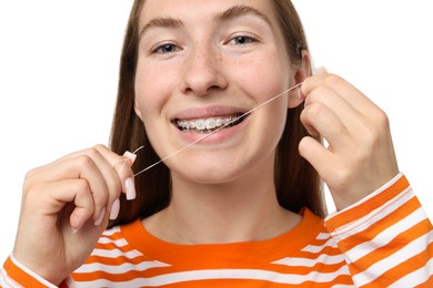 Photo of Smiling girl with braces cleaning teeth with dental floss on white background