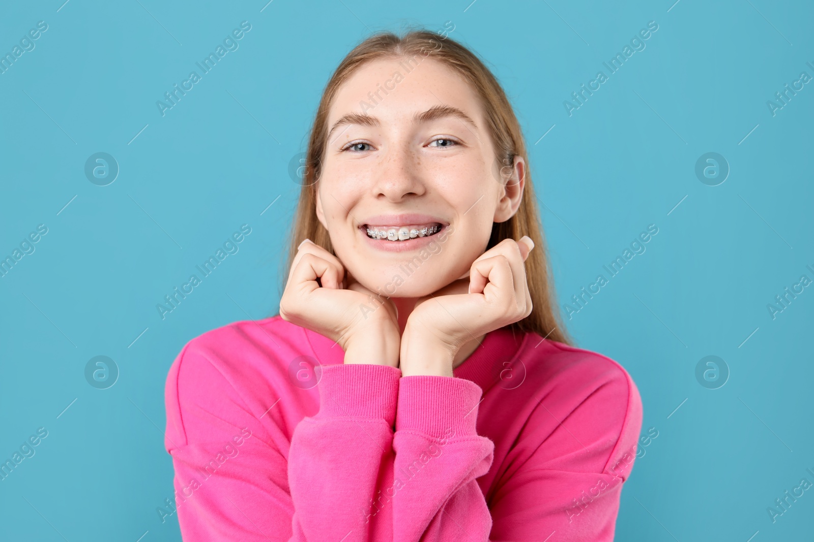 Photo of Smiling girl with braces on light blue background