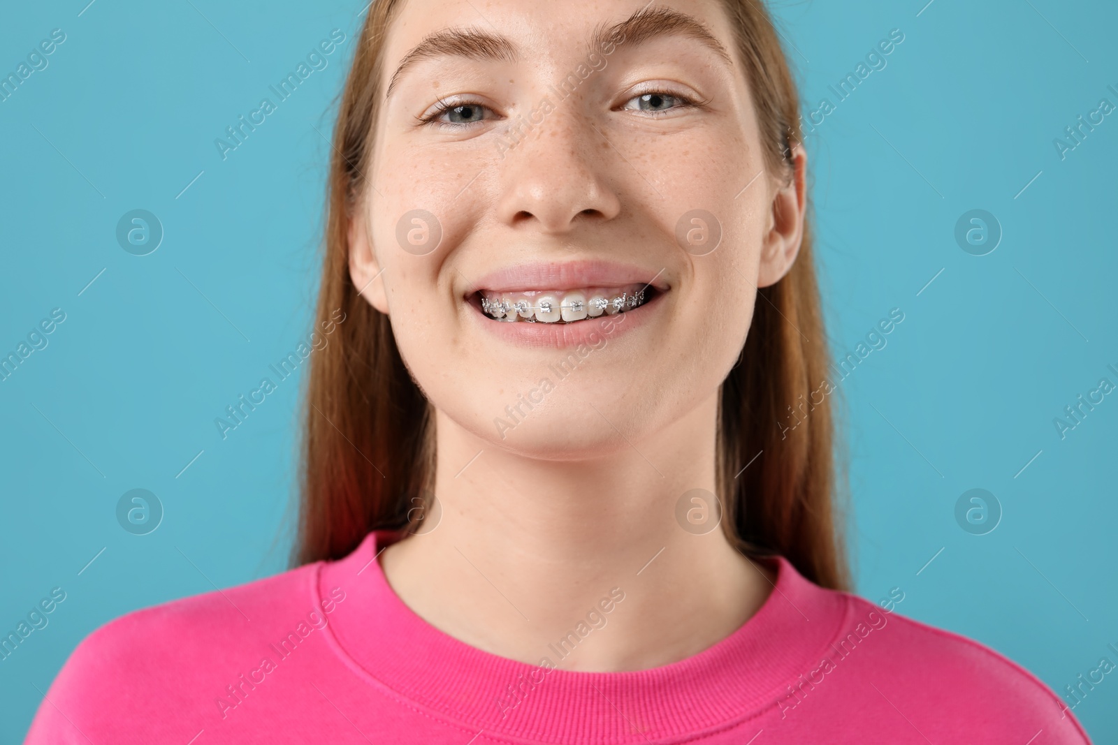 Photo of Smiling girl with braces on light blue background