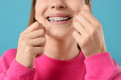 Photo of Girl with braces cleaning teeth with dental floss on light blue background, closeup