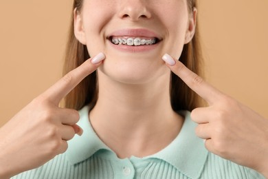 Photo of Girl pointing at her braces on beige background, closeup