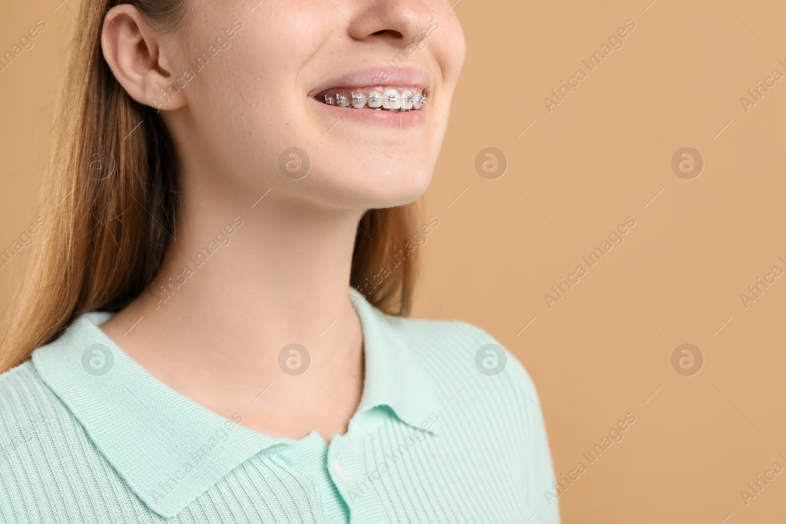 Photo of Girl with braces on beige background, space for text