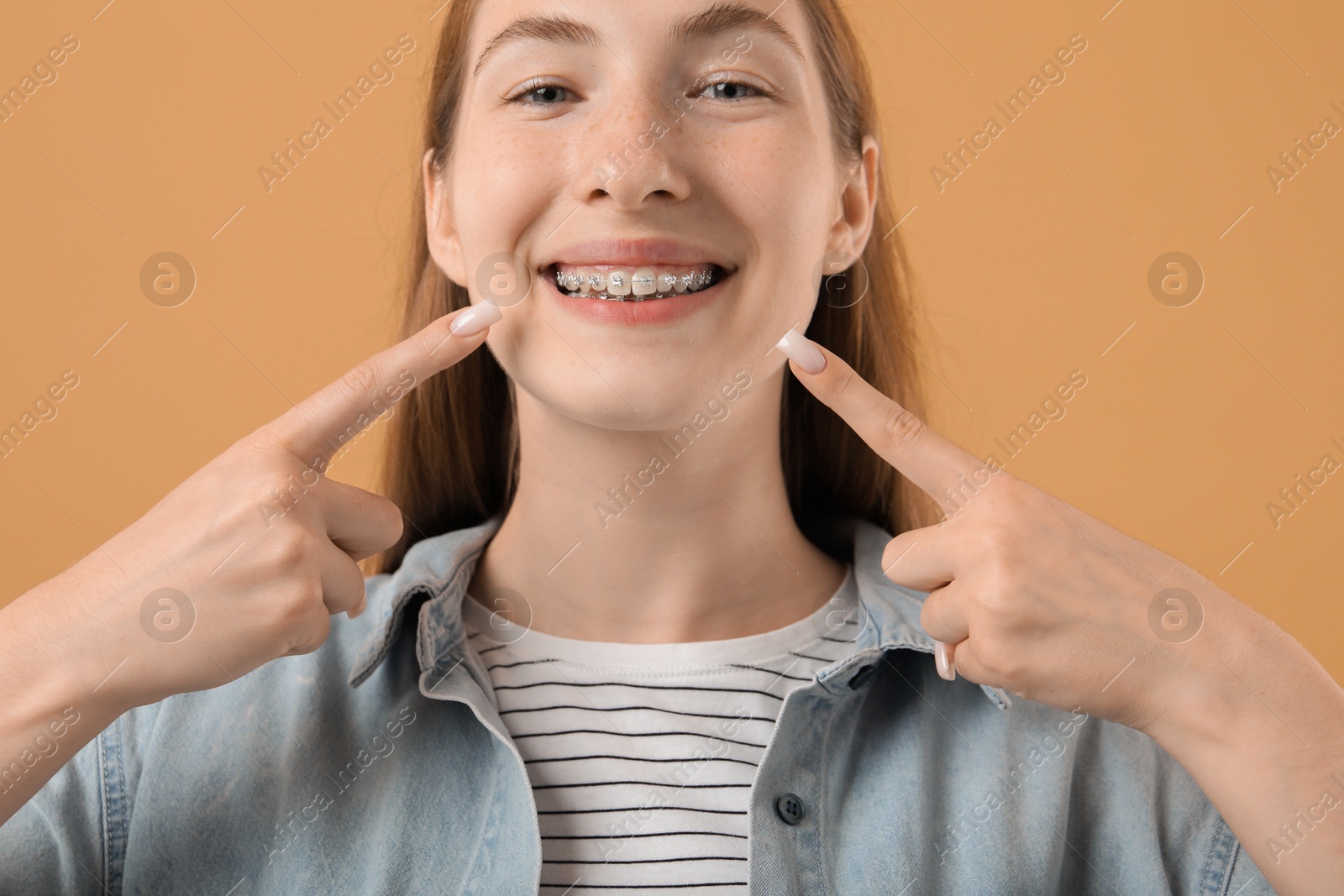 Photo of Girl pointing at her braces on beige background