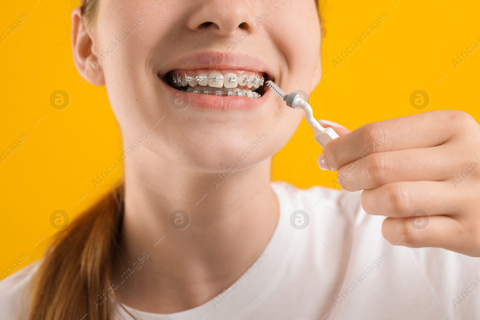 Photo of Girl with braces cleaning teeth with interdental brush on orange background, closeup