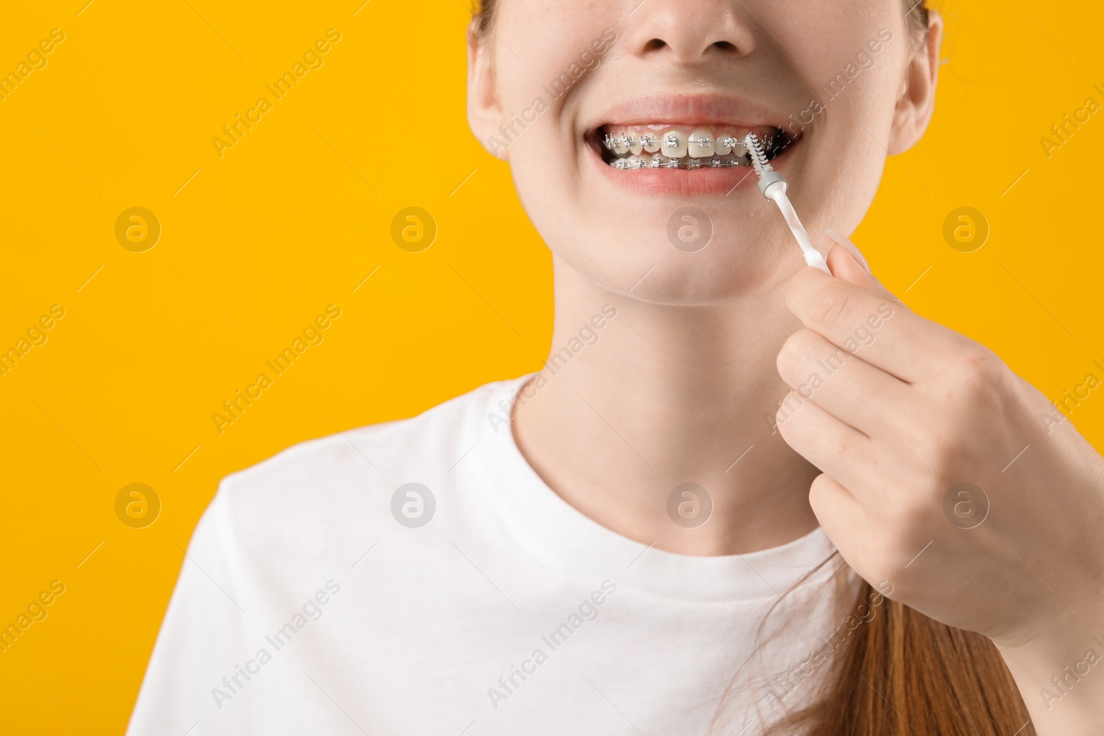 Photo of Girl with braces cleaning teeth with interdental brush on orange background, closeup