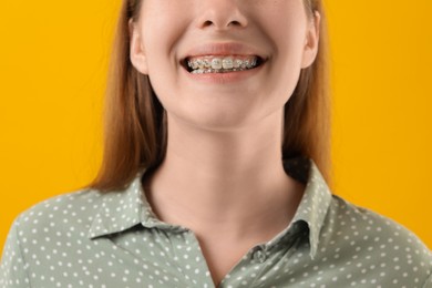 Photo of Girl with braces on orange background, closeup