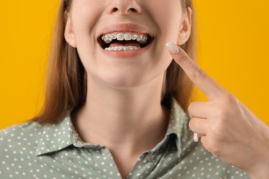 Photo of Girl pointing at her braces on orange background, closeup