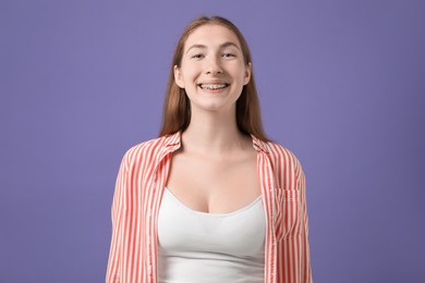 Photo of Smiling girl with braces on purple background