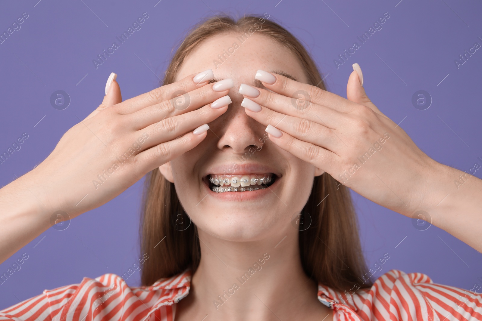 Photo of Smiling girl with braces covering eyes on purple background