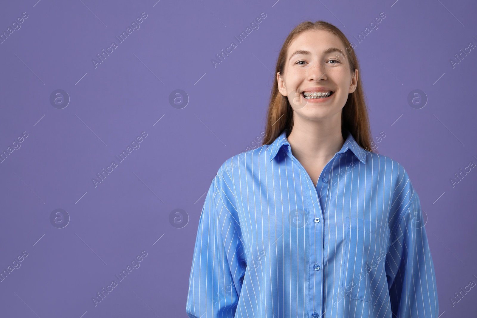 Photo of Smiling girl with braces on purple background, space for text