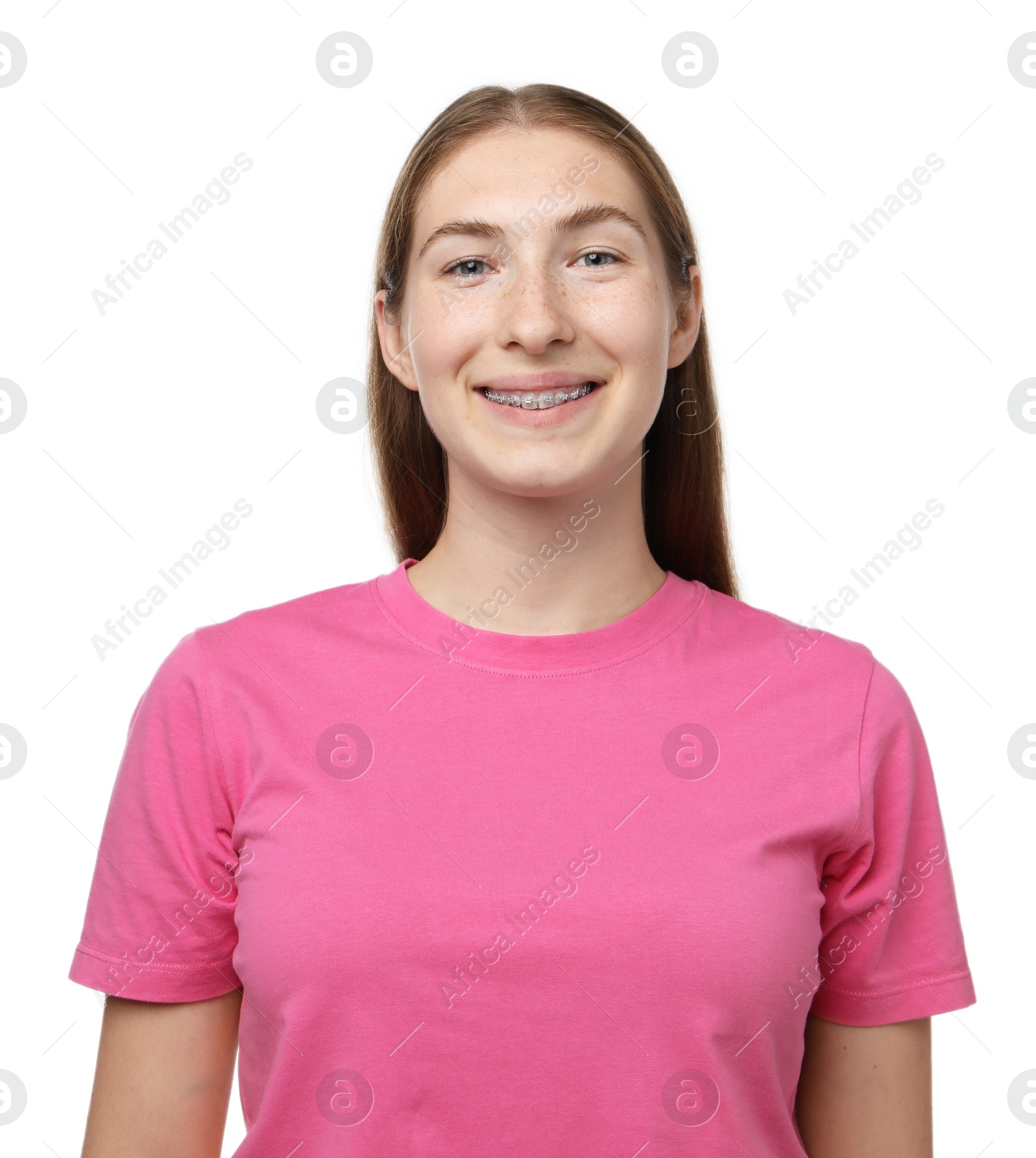 Photo of Smiling girl with braces on white background