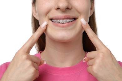 Photo of Girl pointing at her braces on white background, closeup