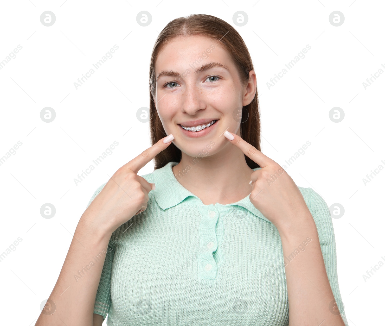 Photo of Smiling girl pointing at her braces on white background