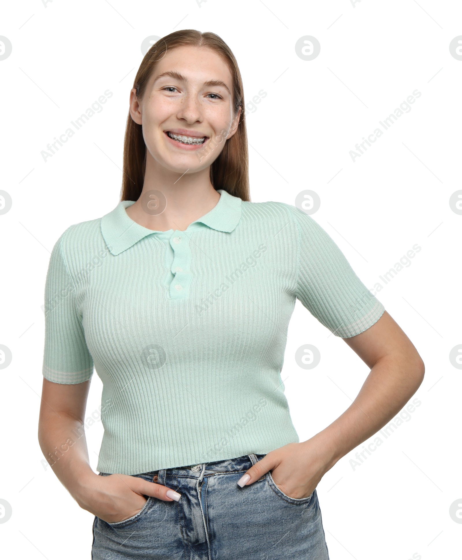 Photo of Smiling girl with braces on white background