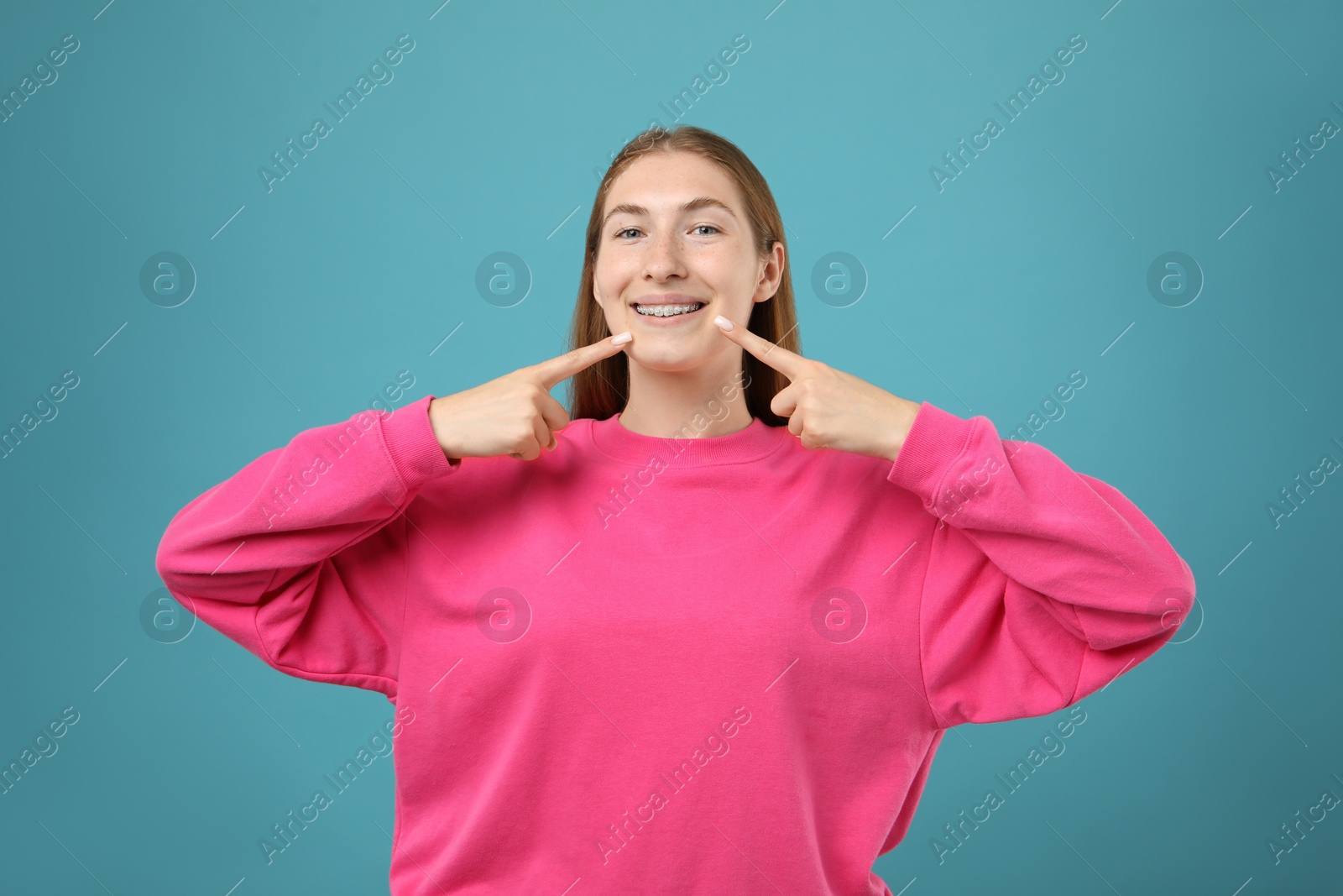 Photo of Girl pointing at her braces on light blue background