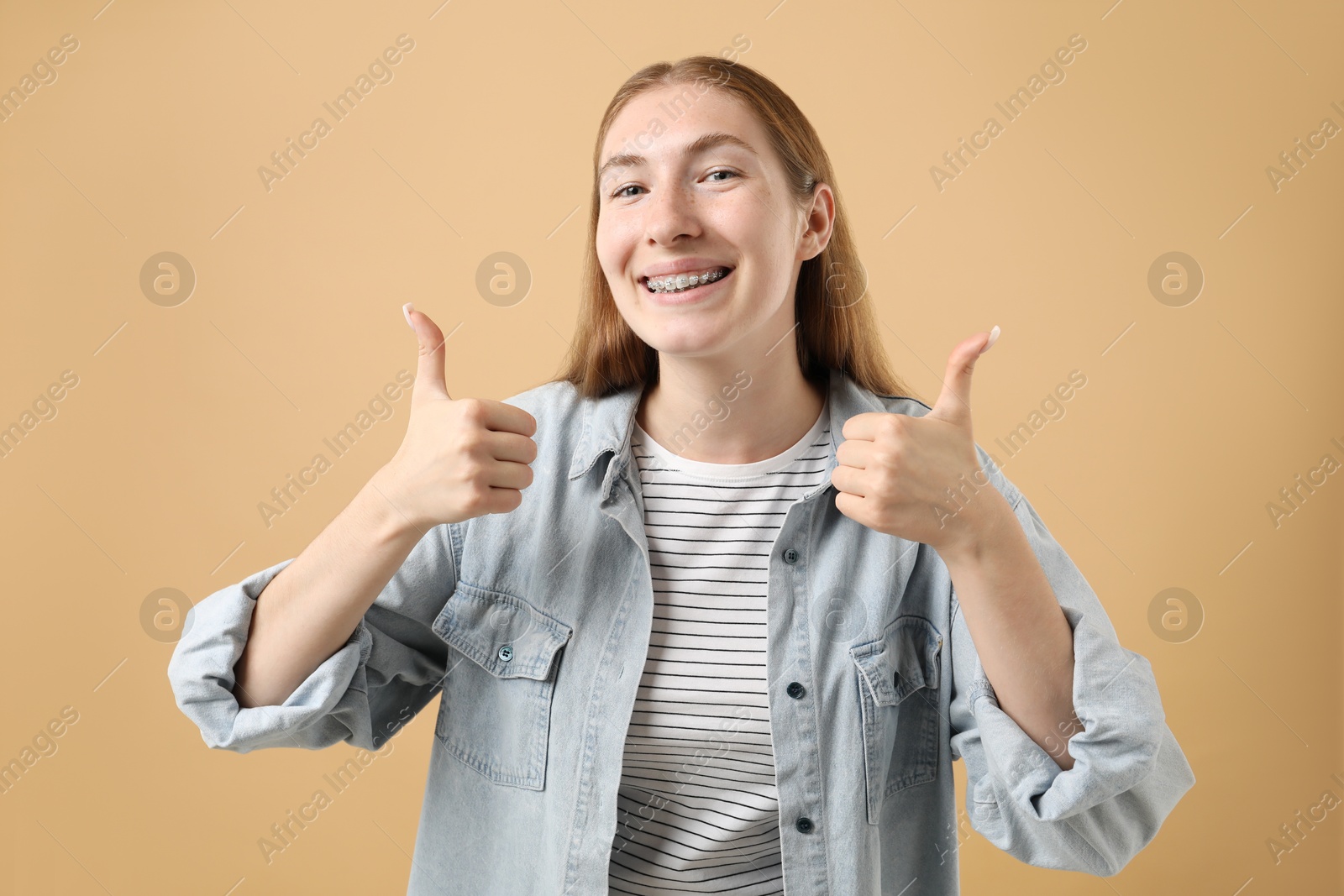 Photo of Smiling girl with braces showing thumbs up on beige background