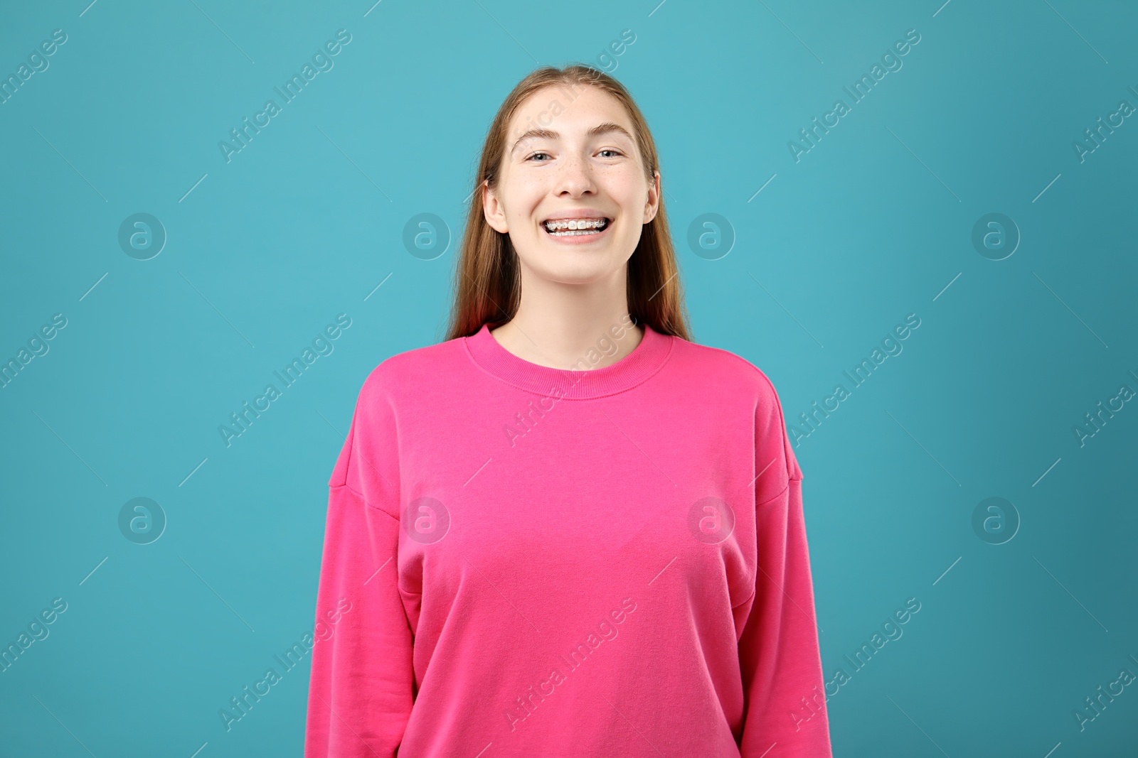 Photo of Smiling girl with braces on light blue background