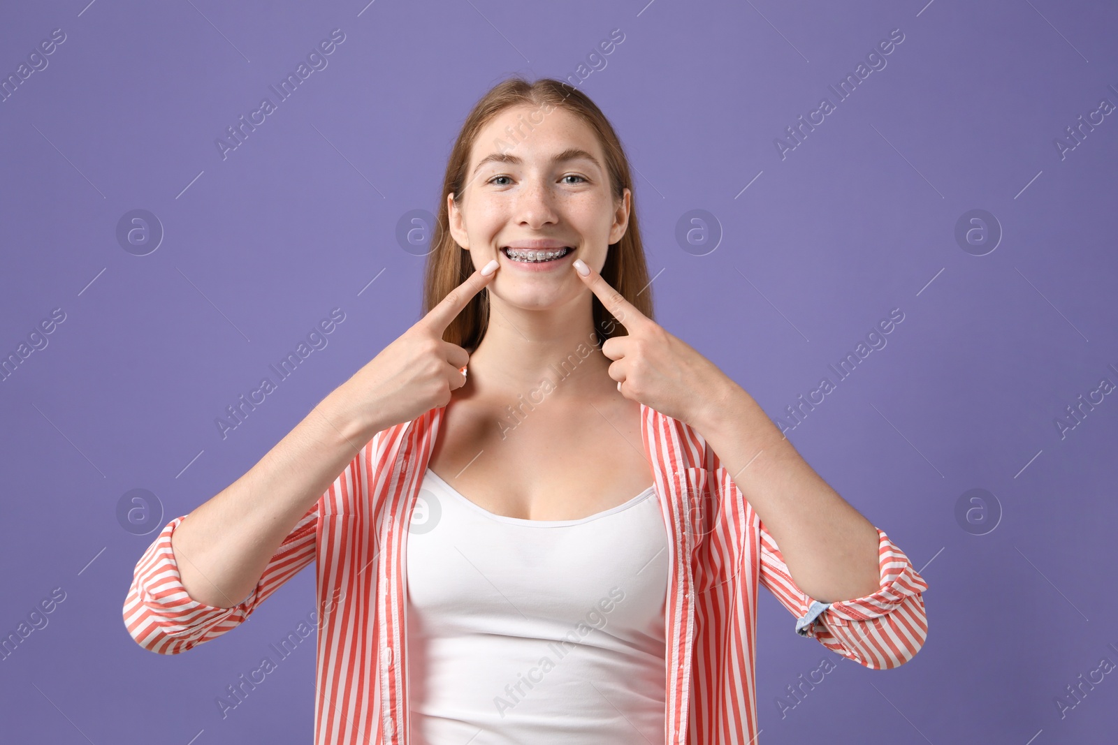 Photo of Girl pointing at her braces on purple background