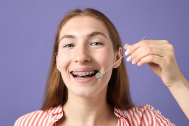 Photo of Girl with braces using dental mirror on purple background