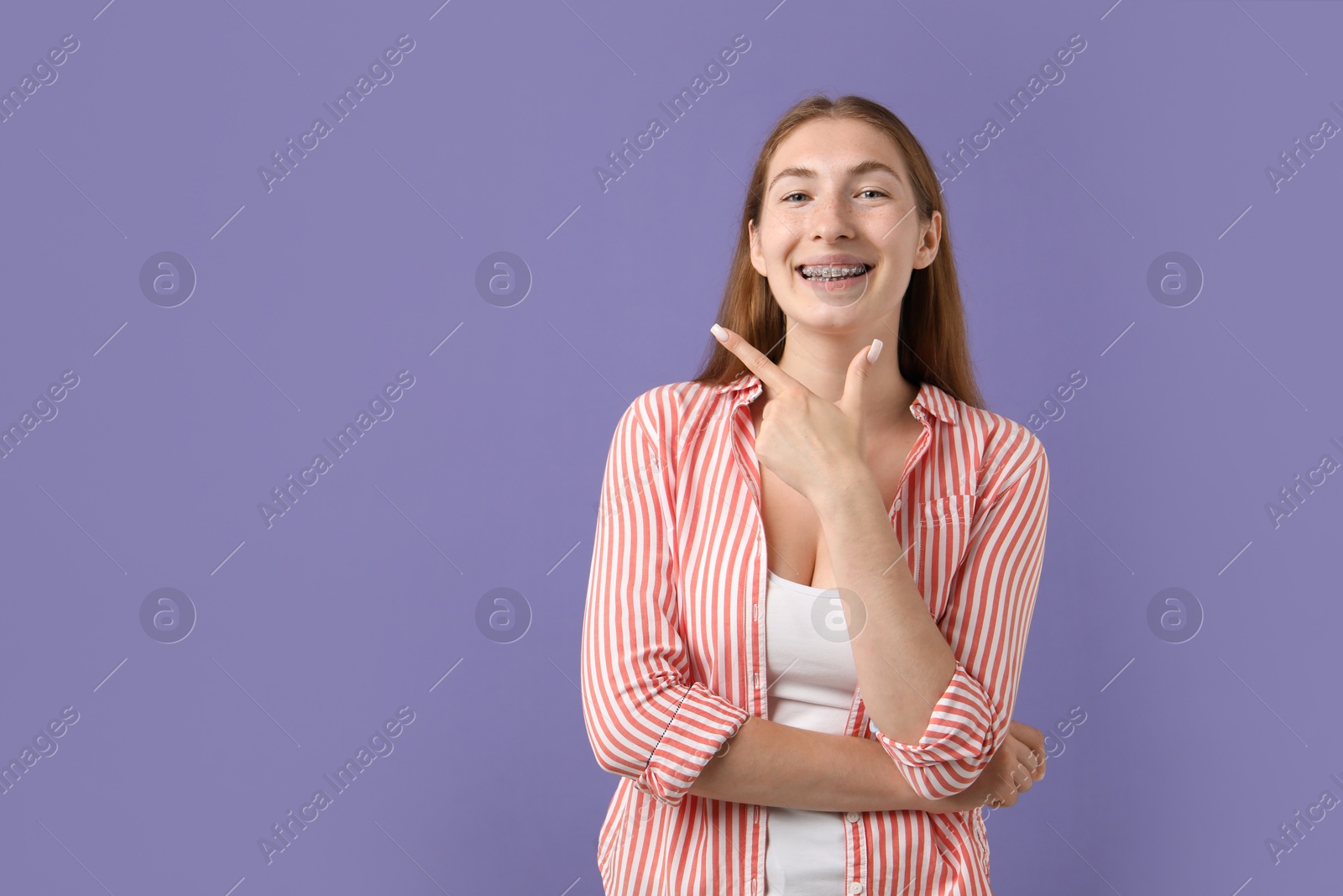 Photo of Smiling girl with braces on purple background, space for text